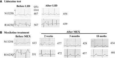 Gating Properties of Mutant Sodium Channels and Responses to Sodium Current Inhibitors Predict Mexiletine-Sensitive Mutations of Long QT Syndrome 3